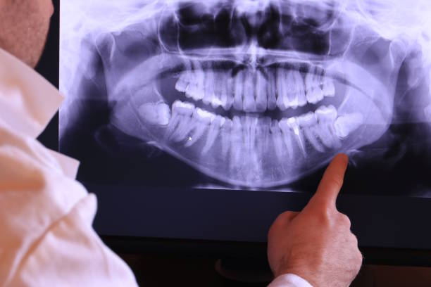 Best Emergency Broken Tooth Repair in Desert Hills, AZ
